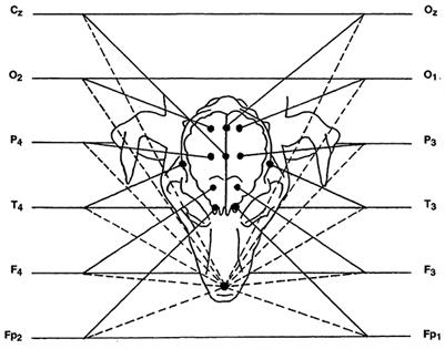 Electroencephalographic features of the developing brain in 72 dogs under xylazine sedation: a visual and statistical analysis